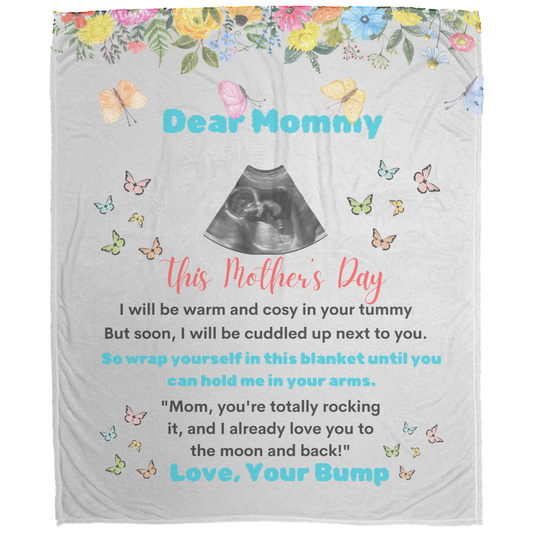 Expecting Mom's Personalized Sonogram | Plush Fleece Blanket - 50x60